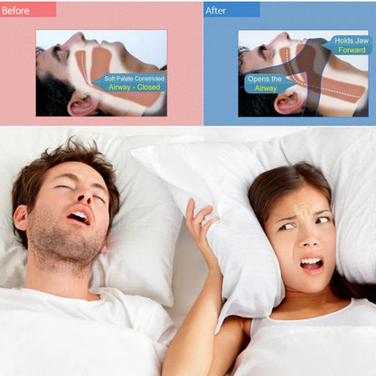 SleepEase™ Anti Snoring Chin Strap
